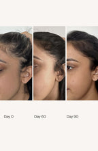 Thicker, Fuller Hair in as Little as 90 Days