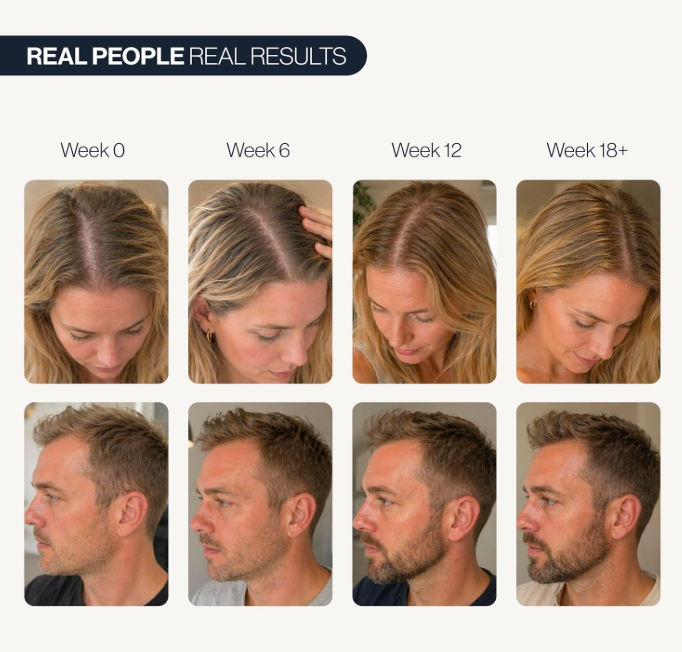 Thicker, Fuller Hair in as Little as 90 Days