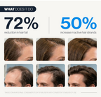 Thicker, Fuller Hair in as Little as 90 Days
