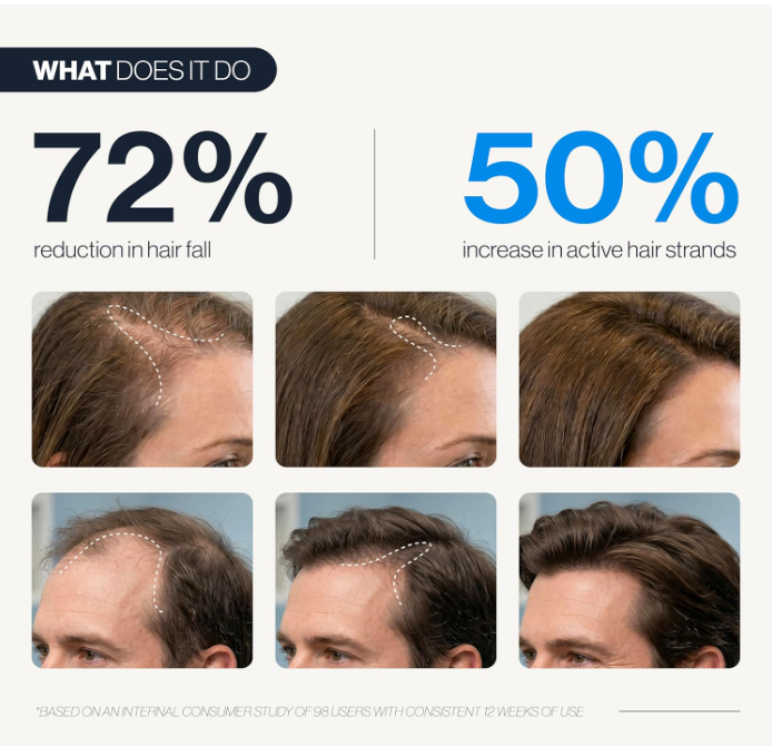 Thicker, Fuller Hair in as Little as 90 Days