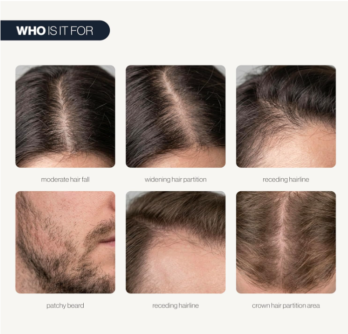 Thicker, Fuller Hair in as Little as 90 Days
