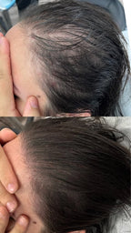 Thicker, Fuller Hair in as Little as 90 Days